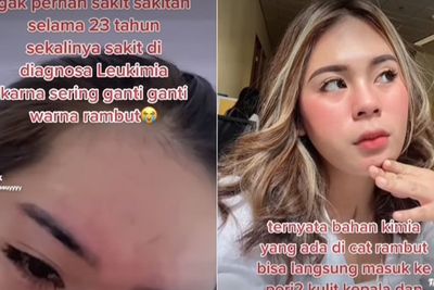 Wanita Ini Didiagnosa Leukemia Gara-gara Sering Cat Rambut, Sampai Nyesal