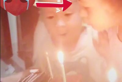 Duh! Niat Mau Tiup Lilin Ultah, Rambut Anak Ini Malah Gak Sengaja Terbakar