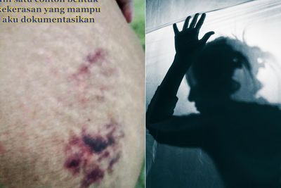 Perjuangan Anak Rawat Ibu Pengidap Skizofrenia, Harus Menahan Sakit saat Dapat Kekerasan