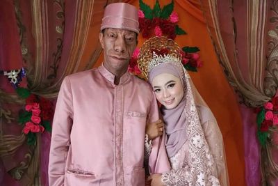 Punya Fisik Unik , Surya Manurung Sukses Pinang Wanita Cantik Asal Riau