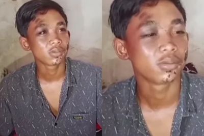 Kesaksian Korban Kanjuruhan, Sedih! Niat Mau Pulang Malah Kena Semprot Gas Air Mata