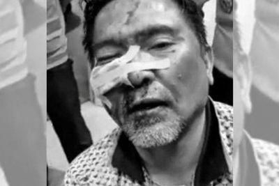 Wajah Babak Belur Muhammad John Pilot Batik Air, Bikin Onar dalam Penerbangan dari Turki