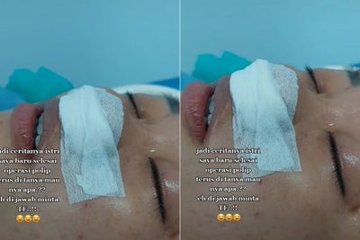 Ditanya Suami Usai Operasi Polip, Jawaban Wanita Ini Bikin Netizen Ngakak