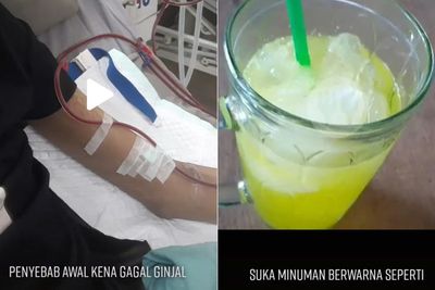 Pemuda Ini Kena Gagal Ginjal Akibat Suka Minuman Soda Tapi Kurang Minum Air Putih