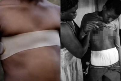 Cara Aneh Anak Afrika Terhindar dari Pria Hidung Belang, Rela Disetrika Payudaranya