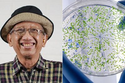Profesor Zubairi Djoerban Angkat Bicara soal Pandemic Superbugs yang Menyebar di India