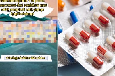 Minum Obat Pereda Nyeri untuk Mengobati Gigi Berlubang, Lambung Pria Ini Bocor