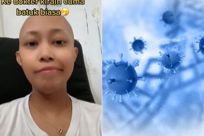 Cerita Wanita Idap Kanker Limfoma Stadium 4, Sempat Mengira Cuma Batuk Biasa