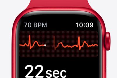 Berkat Apple Watch, Gadis 12 Tahun Selamat dari Penyakit Kanker!