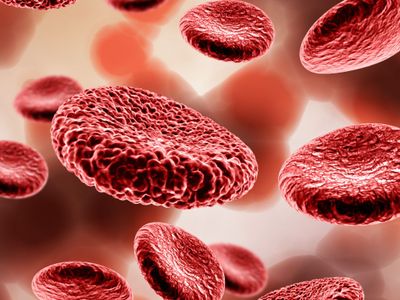 Anemia Tak Kunjung Membaik Waspadai Munculnya Tanda Penyakit Multiple Myeloma