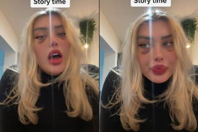 Curhat Seorang Model OnlyFans yang Kepalanya Meledak Usai Operasi Plastik