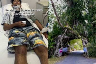 Pria Ini Alami Insiden Misterius Saat Bikin Konten di Bali, Kaki dan Wajahnya Sampai Luka