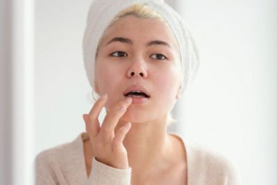 5 Perawatan Mudah Cegah Bibir Kering dan Pecah-pecah
