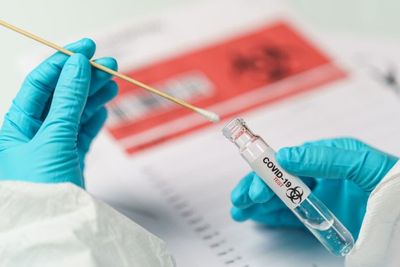 Kasus COVID-19 di Indonesia Mendekati 5 Ribu, IDI Beberkan Penyebabnya