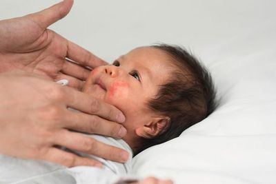 Kenali 10 Jenis Penyakit Kulit Pada Anak yang Berbahaya