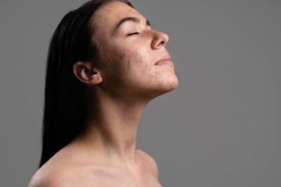 Imunitas Menurun Ternyata Bikin Kulit Sensitif, Ini Penjelasan Dermatologis