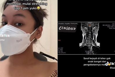 Duduk di Depan Laptop 8 Jam Nonstop, Wanita Ini Alami Saraf Kejepit, Ini Bahaya Lainnya!