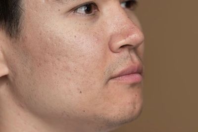 5 Cara Mengecilkan Pori-pori Wajah Paling Efektif, Lakukan Rutin!
