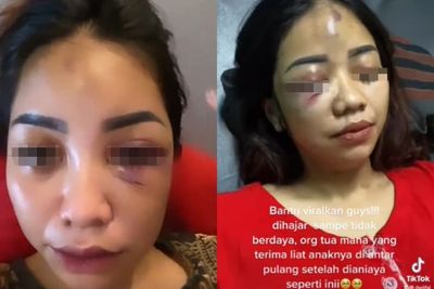 Motif Perempuan Cantik yang Dianiaya Kekasih, Enggak Terima Dituduh Selingkuh