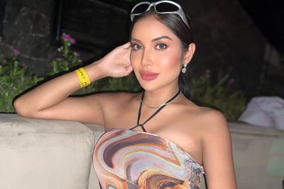 Wajah Millen Cyrus Makin Kencang dan Kinclong, Dokter Ini Bongkar Rahasianya