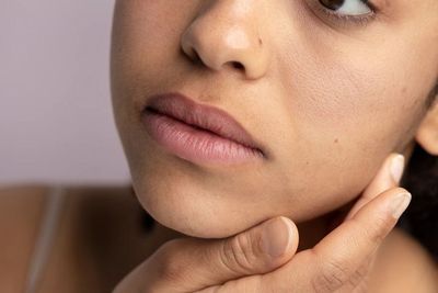 3 Cara Mengatasi Kulit Over-Exfoliating, Lakukan Secara Rutin!