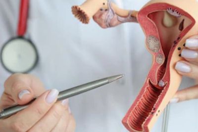Jenis-jenis Pengobatan Kanker Vagina yang Perlu Kamu Tahu