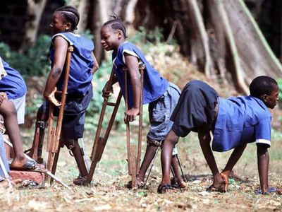 Mengenal Polio, Penyakit Menular yang Harus Diwaspadai Setiap Orangtua
