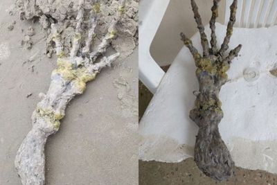Lagi Jalan-jalan, Pasangan di Brasil Temukan Kerangka Mirip Tangan Alien!