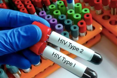 1 Desember Hari AIDS Sedunia, Apa Bedanya HIV dan AIDS?