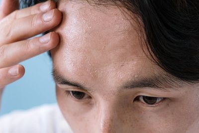 Sebanyak 12.533 Anak di Bawah 14 Tahun yang Terinfeksi HIV Didominasi Laki-Laki