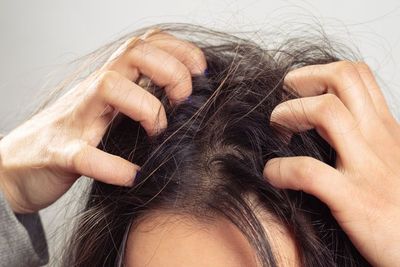 Rambut Penuh Kutu? Ketahui Penyebab dan Cara Mengatasinya!