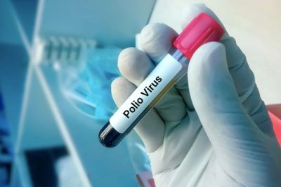 Menginfeksi 4 Anak di Aceh, Apakah Polio Bisa Serang Orang Dewasa?