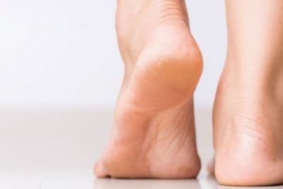 Hindari! Ini 7 Penyebab yang Bisa Bikin Kaki dan Tumit Kering dan Pecah-Pecah