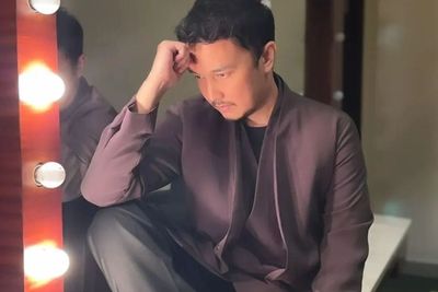 Dimas Aditya Pengen Gondrong Usai Transplantasi Rambut: Semoga Gak Malu-maluin