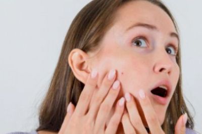 Pakai Acne Patch atau Obat Totol, Mana yang Lebih Bagus?