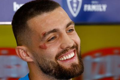 Waduh! Muka Kovacic Lebam Jelang Lawan Brasil, Kenapa Tuh?