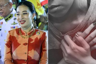 Diidap Putri Bungsu Raja Thailand, Kenali Sejumlah Gejala Penyakit Jantung Ini!