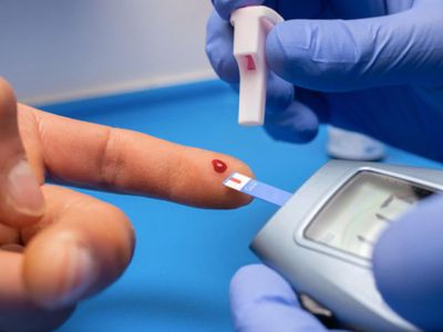 5 Vitamin yang Dipercaya Turunkan Kolesterol Tinggi, Tapi Awas Ada Efek Sampingnya!