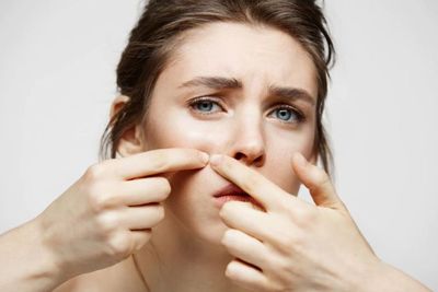 3 Skincare Ini Bantu Mengatasi Jerawat, Gak Usah Bete Lagi!