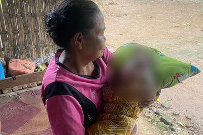 Tolong! Kisah Pilu Bayi Tanpa Tempurung Kepala di Ponorogo, Butuh Biaya Operasi