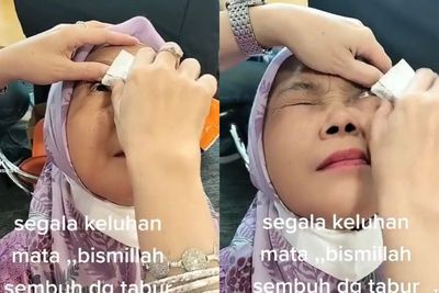 Pengobatan Mata Katarak Pakai Serbuk, Dokter: Hanya Bisa Disembuhkan dengan Operasi