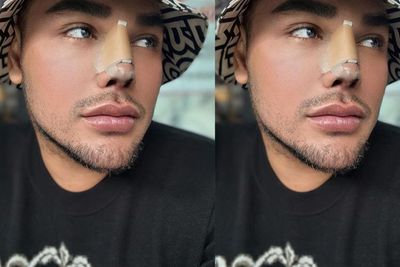 Ivan Gunawan Pamer Permak Hidung, Singgung soal Self Love Kunci Kebahagiaan