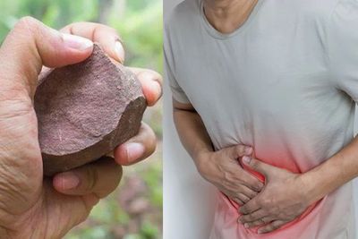 Bukan Mitos, Ternyata Ada Loh Alasan Masuk Akal Mengapa Batu Bisa Hilangkan Mules Dadakan