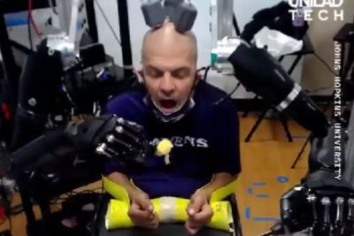 Penderita Quadriplegia Andalkan Robot AI yang Diatur dari Pikirannya untuk Beraktivitas