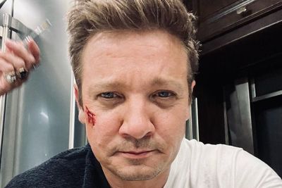 Jeremy Renner Sudah Sadarkan Diri, Pamer Foto Selfie Muka Penuh Lebam