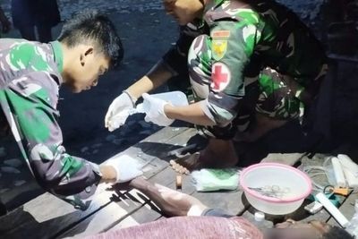 Diseruduk Babi Hutan Hingga Terima 27 Jahitan, Warga Kampung Batom Alami Luka Parah