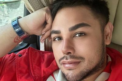 Beda Hidung Ivan Gunawan Sebelum dan Sesudah Oplas: Wajahnya Lebih Muda Mak