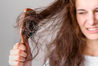 Kebanyakan Minum Manis Bisa Sebabkan Rambut Rontok, Ini Penjelasannya