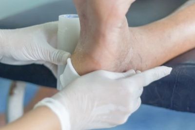 Selama Ini Salah Kaprah, Istilah Diabetes Kering dan Basah Itu Tidak Ada
