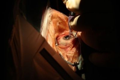 7 Kasus Mengerikan Penjualan Organ Tubuh di Dunia, Nomor 1 dari Indonesia